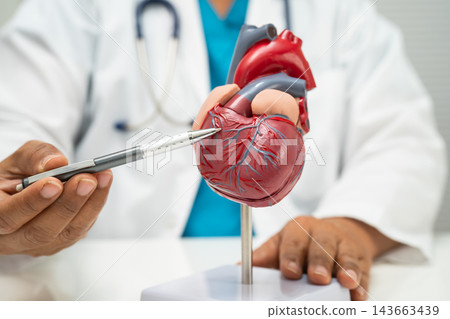 Cardiovascular disease CVD, doctor with heart human model. Cardiovascular disease CVD, doctor with heart human model. 143663439