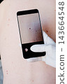 A gloved hand holds a smartphone over a bare back, with the screen magnifying one mole among many on the skin. Mole mapping and regular self-monitoring support early skin cancer detection. 143664548