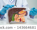 Pancreatitis, pancreatic cancer, Asian doctor with pancreas, gallbladder and bile duct human model. 143664681