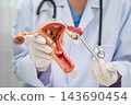 Uterus, doctor holding human anatomy model for study diagnosis and treatment in hospital. 143690454