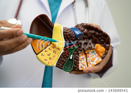 Pneumonia, lung cancer, Asian doctor holding human anatomy model for study diagnosis and treatment in hospital. Pneumonia, lung cancer, Asian doctor holding human anatomy model for study diagnosis and treatment in hospital. 143699541