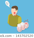 3D Isometric Flat Vector Illustration of Wisdom Tooth Problem, Experiencing Pain In Gums 143702520