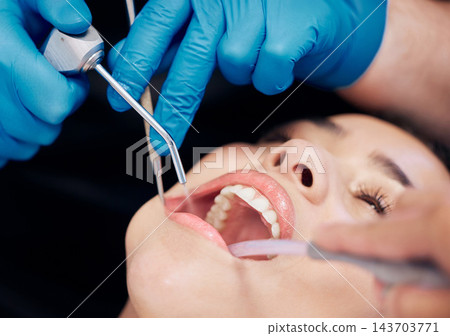 Dental, mouth and woman consutling dentist for teeth whitening, wellness and bacteria, cavity or gingivitis prevention. Oral, procedure and expert with tools for cleaning, inspection or procedure Dental, mouth and woman consutling dentist for teeth whitening, wellness and bacteria, cavity or gingivitis prevention. Oral, procedure and expert with tools for cleaning, inspection or procedure 143703771