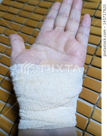 手腕受傷或關節疼痛,用繃帶和藥膏進行治療的醫學影像。 手腕受傷或關節疼痛,用繃帶和藥膏進行治療的醫學影像。 143717920