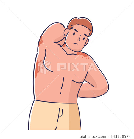 Man Scratching Rash Cartoon Style 143728574