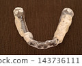 A worn-out, hard-type, resin, height-adjusted night guard mouthpiece made in a Japanese dental clinic. 143736111