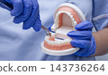 Metal dental crown placement demonstrated on a lower molar model for restorative dentistry education 143736264
