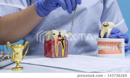 Dental Caries and Endodontic Treatment Education with Dentist Examining Infected Tooth Model and Healthy Teeth 143736269