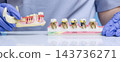 Dentist Demonstrating Stages of Periodontal Disease and Gingivitis Using Detailed Tooth and Gum Anatomy Models 143736271