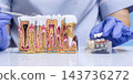 Dentist Demonstrating Dental Implant Supported Bridge and Tooth Replacement Using Detailed Jawbone Anatomy Model in Clinic 143736272