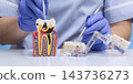 Dentist Demonstrating Advanced Tooth Decay and Root Canal Anatomy with Dental Instruments and Educational Jaw Models 143736273