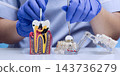 Dentist Demonstrating Severe Tooth Decay and Root Canal Anatomy with Dental Probe and Mirror on Educational Models 143736279
