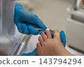 Clinician trims patients big toenail with stainless steel nippers in treatment room. Podiatry care focuses on precise nail grooming, with foot supported by gloved hands during careful trimming. 143794294