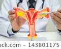 Uterus, doctor holding human anatomy model for study diagnosis and treatment in hospital. 143801175