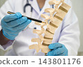 Doctor holding osteoporosis in back bone model. 143801176