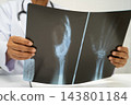 Doctor examining hand ankle joint bone radiography xray film. 143801184