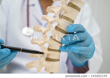 Doctor holding osteoporosis in back bone model for treatment medical. 143802145
