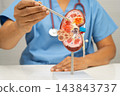Chronic kidney disease, doctor with model for treatment urinary system, urology, Estimated glomerular filtration rate eGFR. 143843737