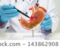 Stomach disease, doctor with anatomy model for study diagnosis and treatment in hospital. 143862908