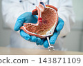 Stomach disease, doctor holding anatomy model for study diagnosis and treatment in hospital. 143871109