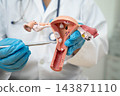 Uterus, doctor holding human anatomy model for study diagnosis and treatment in hospital. 143871110