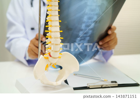 Doctor examining spine bone radiography xray film. Doctor examining spine bone radiography xray film. 143871151