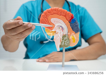 Alzheimer disease, Asian doctor holding brain anatomy model for study diagnosis and treatment in hospital. 143886256