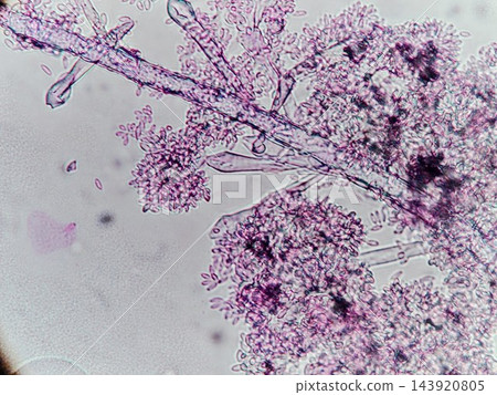 黴菌分生孢子的顯微照片 黴菌分生孢子的顯微照片 143920805